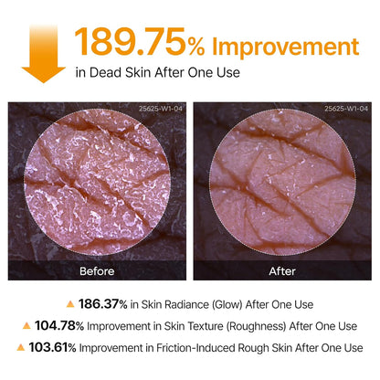 Dr.Melaxin - Peel Shot Kojic Acid Spray